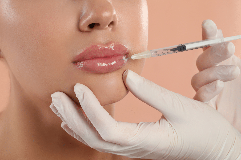 Lip filler top 10 frequently asked questions FAQs common concerns natural lip enhancement best natural results clinic sparrow Md Vancouver physician safety never overdone ha fillers