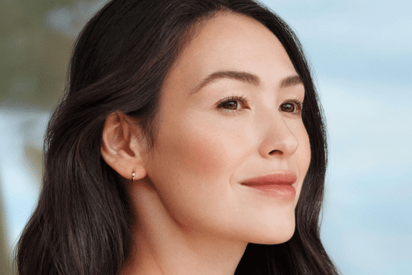 Sculptra treatment guide to understanding biostimulators regenerative medicine best anti-aging skincare clinic Vancouver sparrow Md Sculptra radiesse natural results