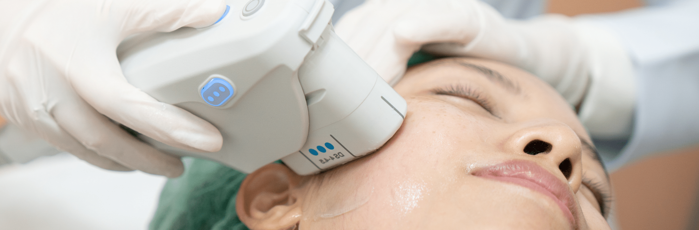 Ultherapy for facial contouring how it works best anti aging ultrasound guided treatment sculpting and lifting non surgical facelift submental area best clinic Vancouver sparrow md