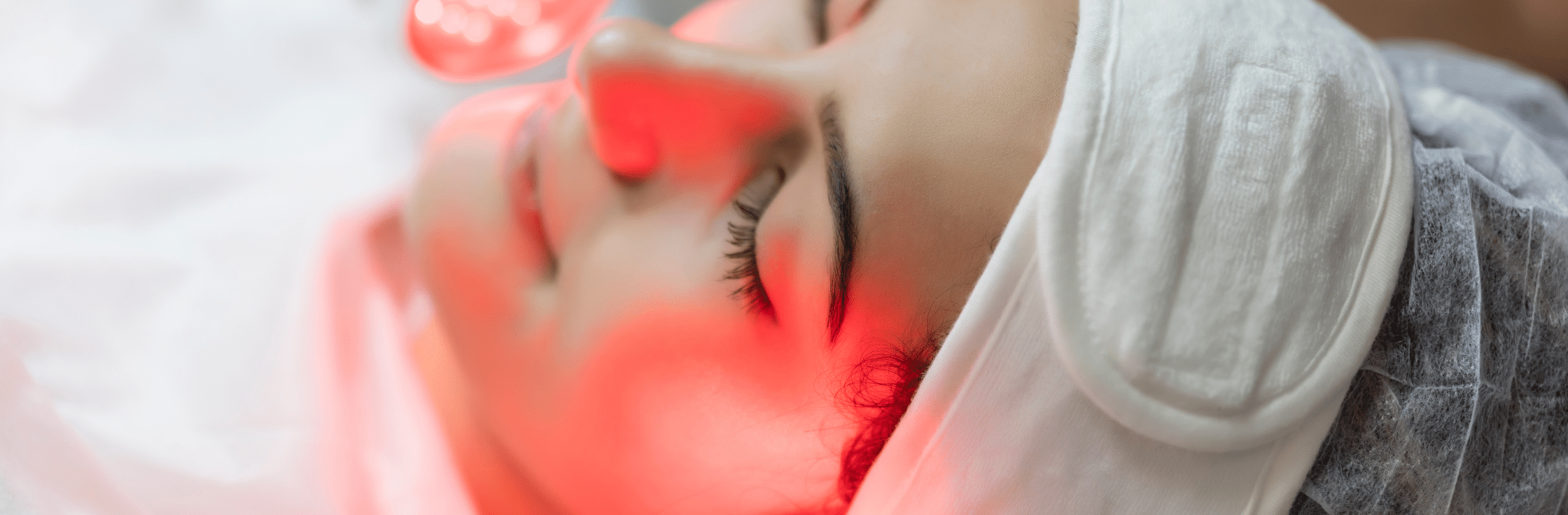 rosacea treatments top treatments for rosacea best facials lasers Ipl skincare clinic Vancouver anti aging inflammaging