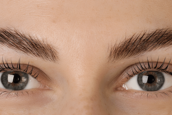 botox brow lift top 6 facts to know understanding how a botox brow lift works nucieva dysport best natural results clinic sparrow md Vancouver