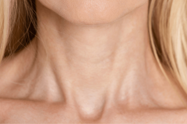 botox for body contouring barbie botox trap slimming elegant neck results trapezius muscle reduction best contouring body clinic Vancouver sparrow md