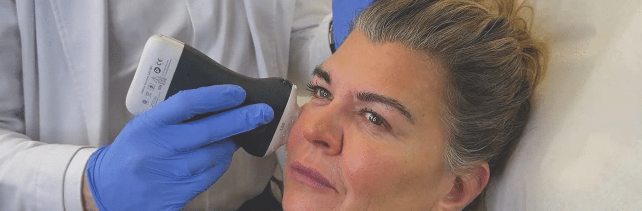 doctor using an ultrasound device in order to detect where the filler is located under the skin