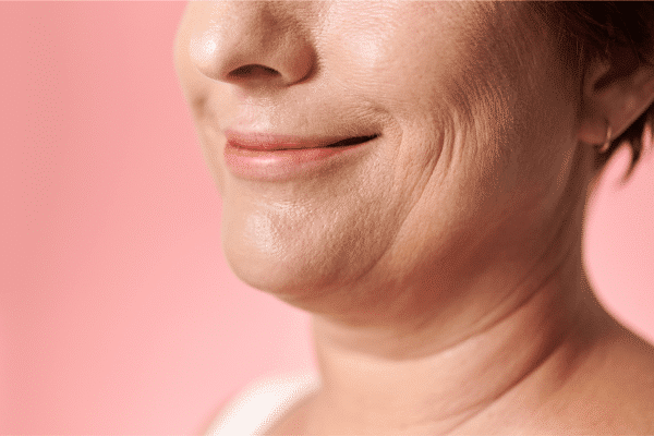 jowls showing in a lady's face while smiling