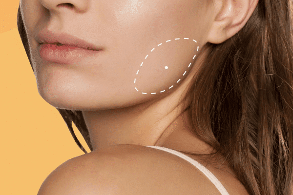 lady highlighting her TMJ muscle where it will be treated with botox for facial slimming